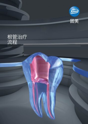 Brochure | Endo Step by Step