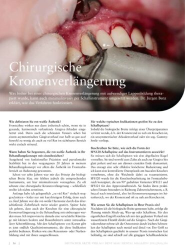 FB | Chirurgische Kronenverlängerung