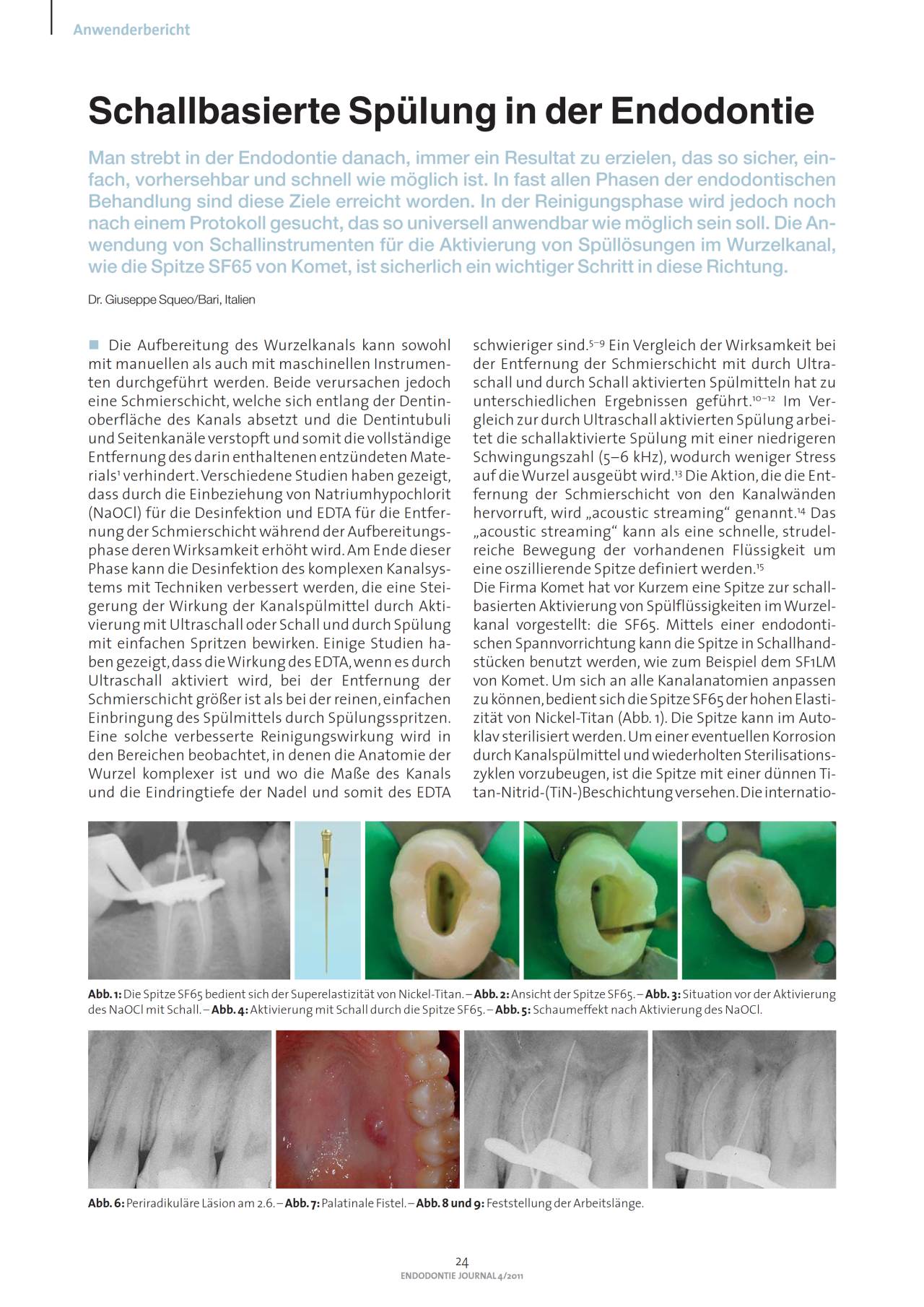 FB Schallbasierte Spülung in der Endodontie › Komet Dental