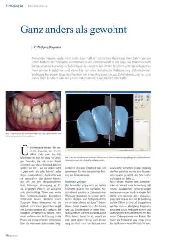 FB | Keramikpolierer