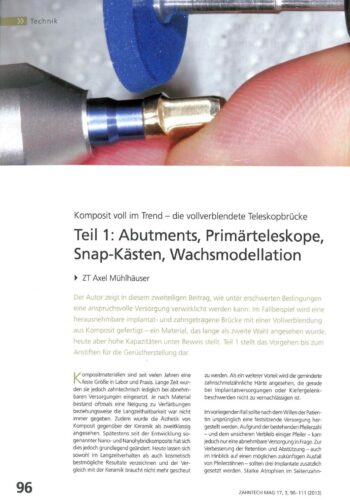 FB | Komposit voll im Trend - die vollverblendendete Teleskopbrücke