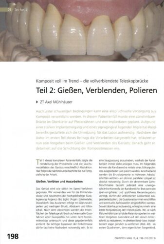 FB | Gießen, Verblenden, Polieren