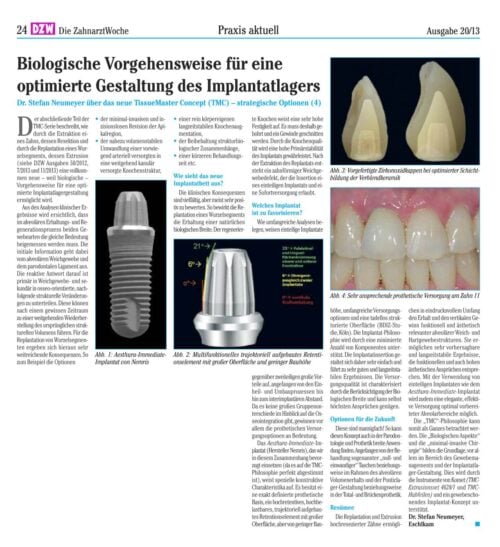 FB | Gestaltung des Implantatlagers