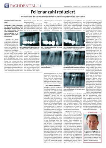 FB | F360 Feilenanzahl reduziert
