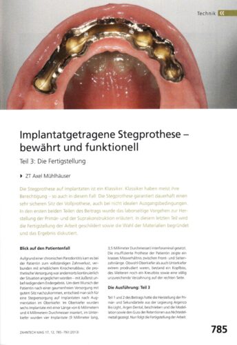 FB | Implantargetragene Stegprothese