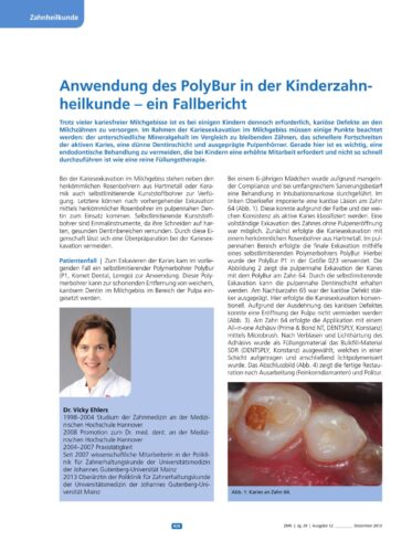 FB | Anwendung des PolyBur in der Kinderzahnheilkunde