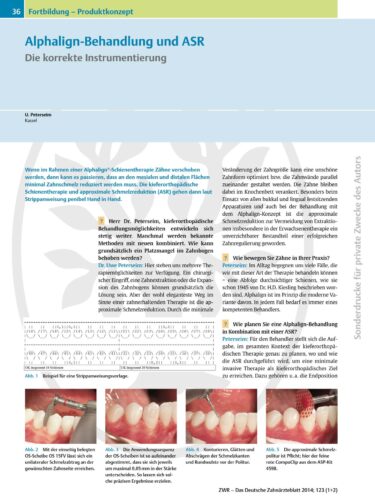 FB | Alphalign-Behandlung und ASR