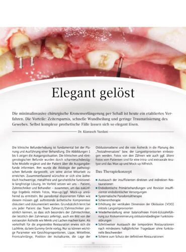 FB | Chirurgische Kronenverlängerung