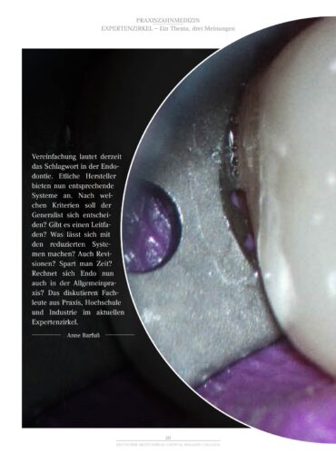 FB | Endodontie: Wie gut ist einfach?
