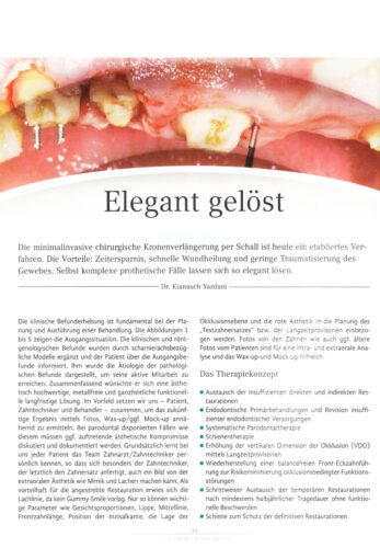 FB | Elegant gelöst