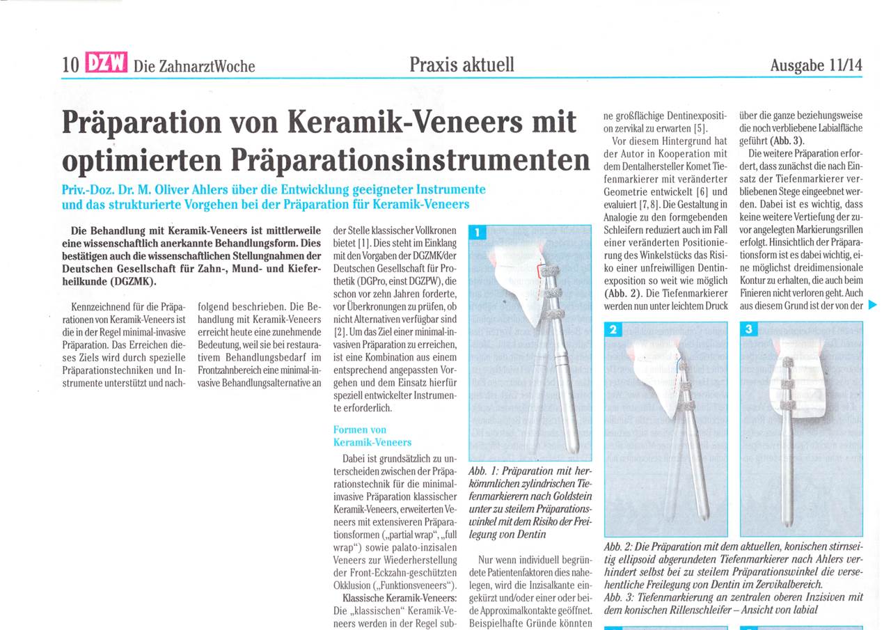 FB Präparation von KeramikVeneers › Komet Dental
