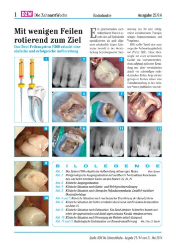 FB | Mit wenigen Feilen rotierend zum Ziel