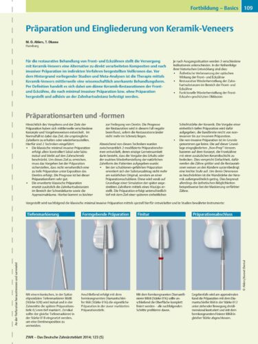 FB | Präparation und Eingliederung von Keramik-Veneers