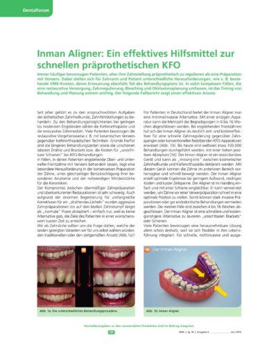 FB | Hilfsmittel zur schnellen präprothetischen KFO