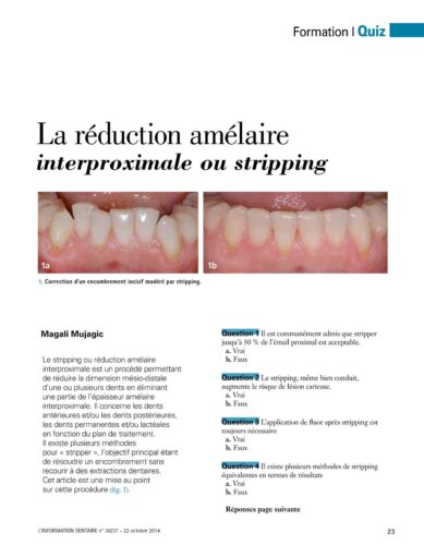 Revue de Presse | Quiz - Réduction amélaire Dr Mujagic