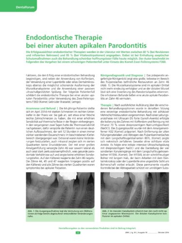 FB | Endodontische Therapie bei einer akuten apikalen Parodontitis