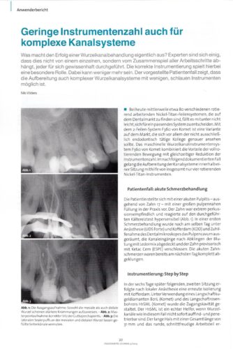 FB | Geringe Instrumentenzahl auch für komplexe Kanalsysteme