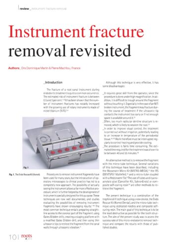 Revue de Presse | Endo Rescue