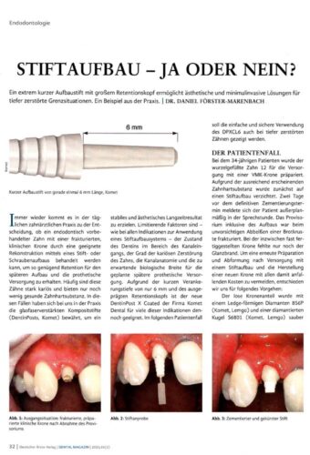 FB | Stiftaufbau - Ja oder Nein?