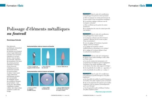 Revue de Presse | Quiz Polissage d'éléments métalliques au fauteuil Dr Estrade