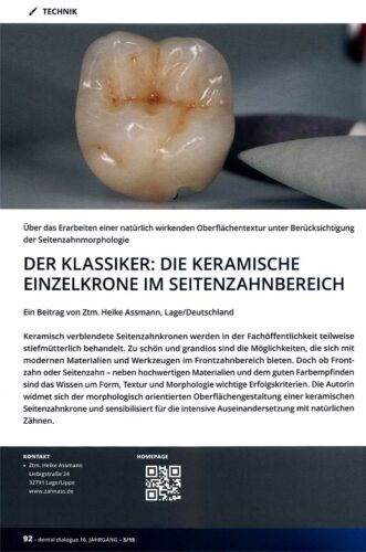 FB | Der Klassiker: Die keramische Einzelkrone im Seitenzahnbereich