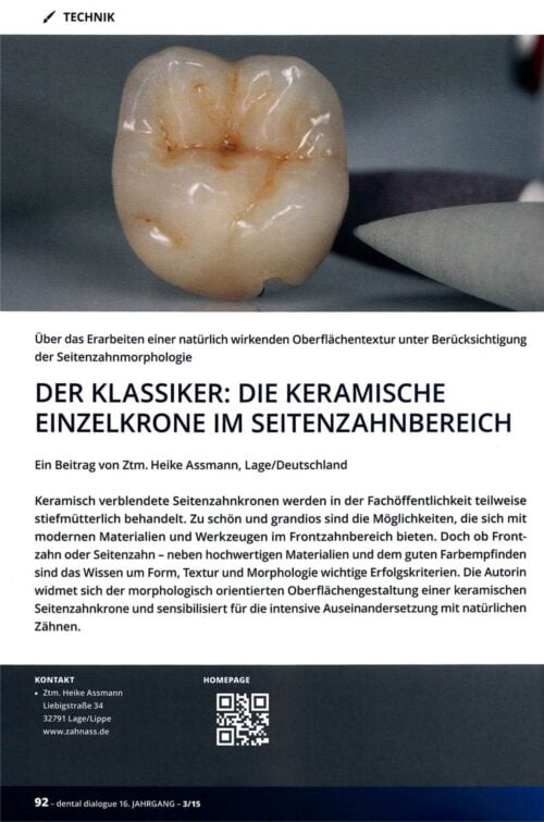 FB | Der Klassiker: Die keramische Einzelkrone im Seitenzahnbereich