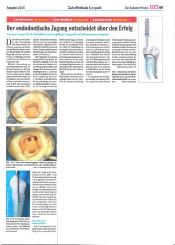 FB | Der endodontische Zugang entscheidet über Erfolg