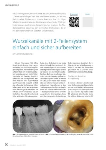 FB | Wurzelkanäle mit 2-Feilensystem einfach und sicher aufbereiten