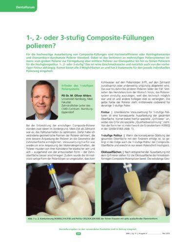 FB | 1-, 2- oder 3-stufig Composite-Füllungen polieren?