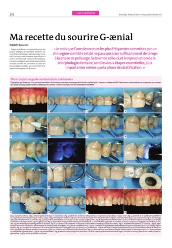 Revue de Presse | Polissage des restaurations antérieures et postérieures