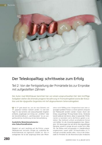 FB | Der Teleskopalltag: schrittweise zum Erfolg