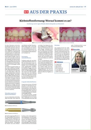 FB | Klebstoffentfernung