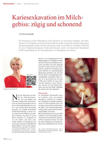 FB | Kariesexkavation im Milchgebiss
