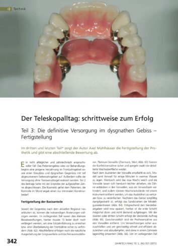 FB | Der Teleskopalltag: schrittweise zum Erfolg