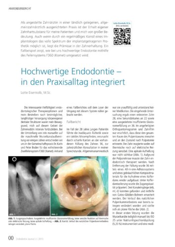 FB | Hochwertige Endodontie - in den Praxisalltag integriert