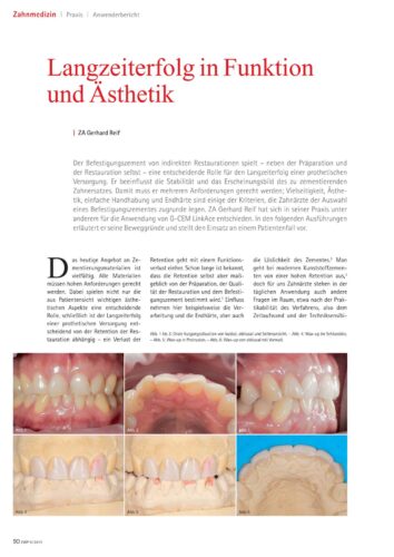 FB | Langzeiterfolg in Funktion und Ästhetik