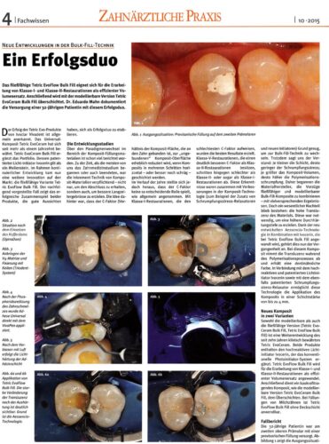 FB | Ausarbeitung einer Composite-Füllung