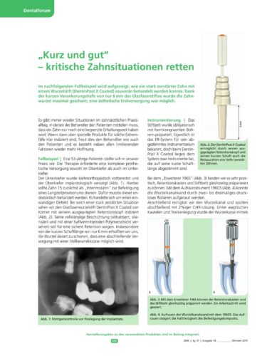 FB | "Kurz und gut" - kritische Zahnsituationen retten