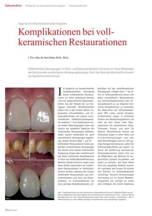 FB | Komplikationen bei vollkeramischen Restaurationen