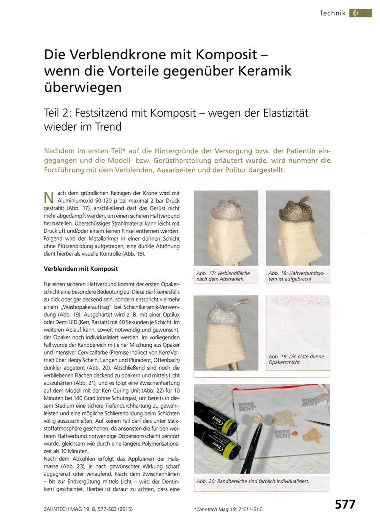 FB Die Verblendkrone mit Komposit wenn die Vorteile gegenüber