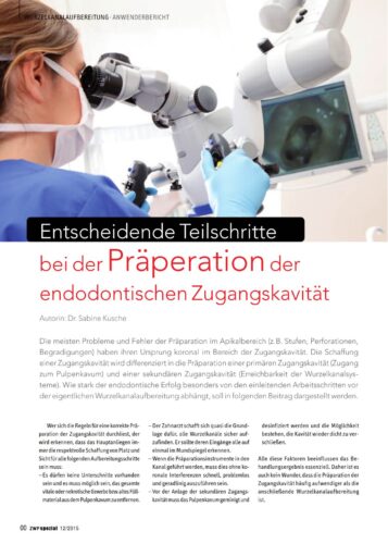FB | Präperation der endodontischen Zugangskavität