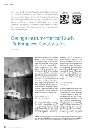 FB | Geringe Instrumentenzahl auch für komplexe Kanalsysteme