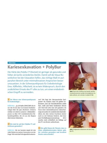 FB | Kariesexkavation + Polybur