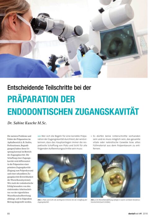 FB | Präperation der endodontischen Zugangskavität