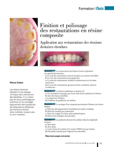 Revue de Presse | Quiz Finition et polissage des composites Dr Colon