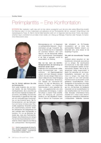 FB | Periimplantitis - Eine Konfrontation
