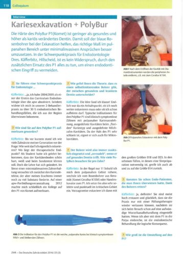 FB | Kariesexkavation + Polybur
