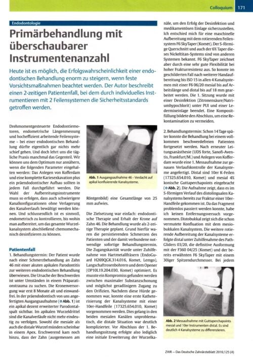 FB | Primärbehandlung mit überschaubarer Instrumentenanzahl