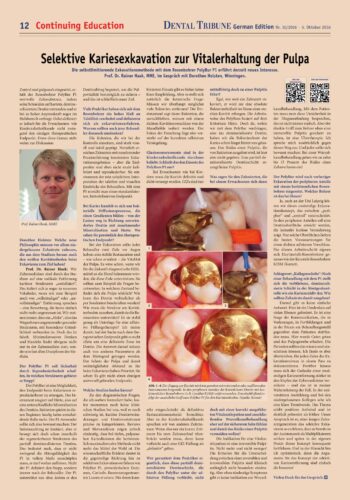 FB | Selektive Kariesexkavation zur Vitalerhaltung der Pulpa