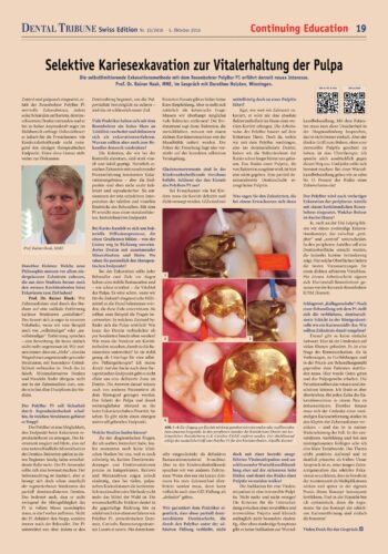 FB | Selektive Kariesexkavation zur Vitalerhaltung der Pulpa